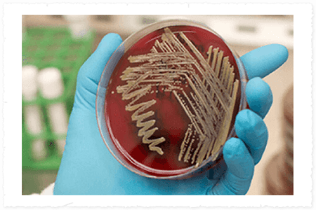 Petri dish with bacterial culture held by a gloved hand